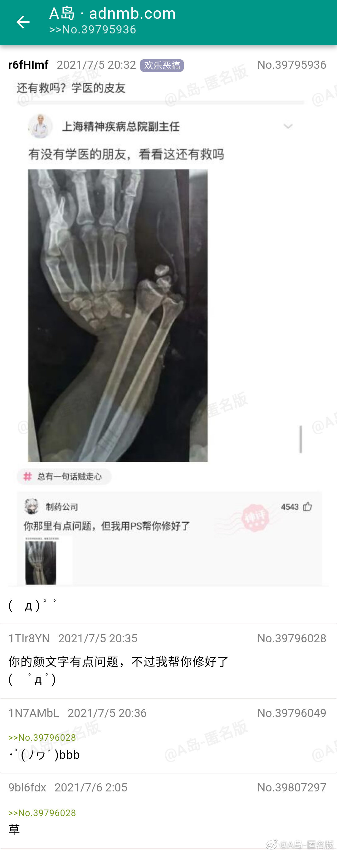 91