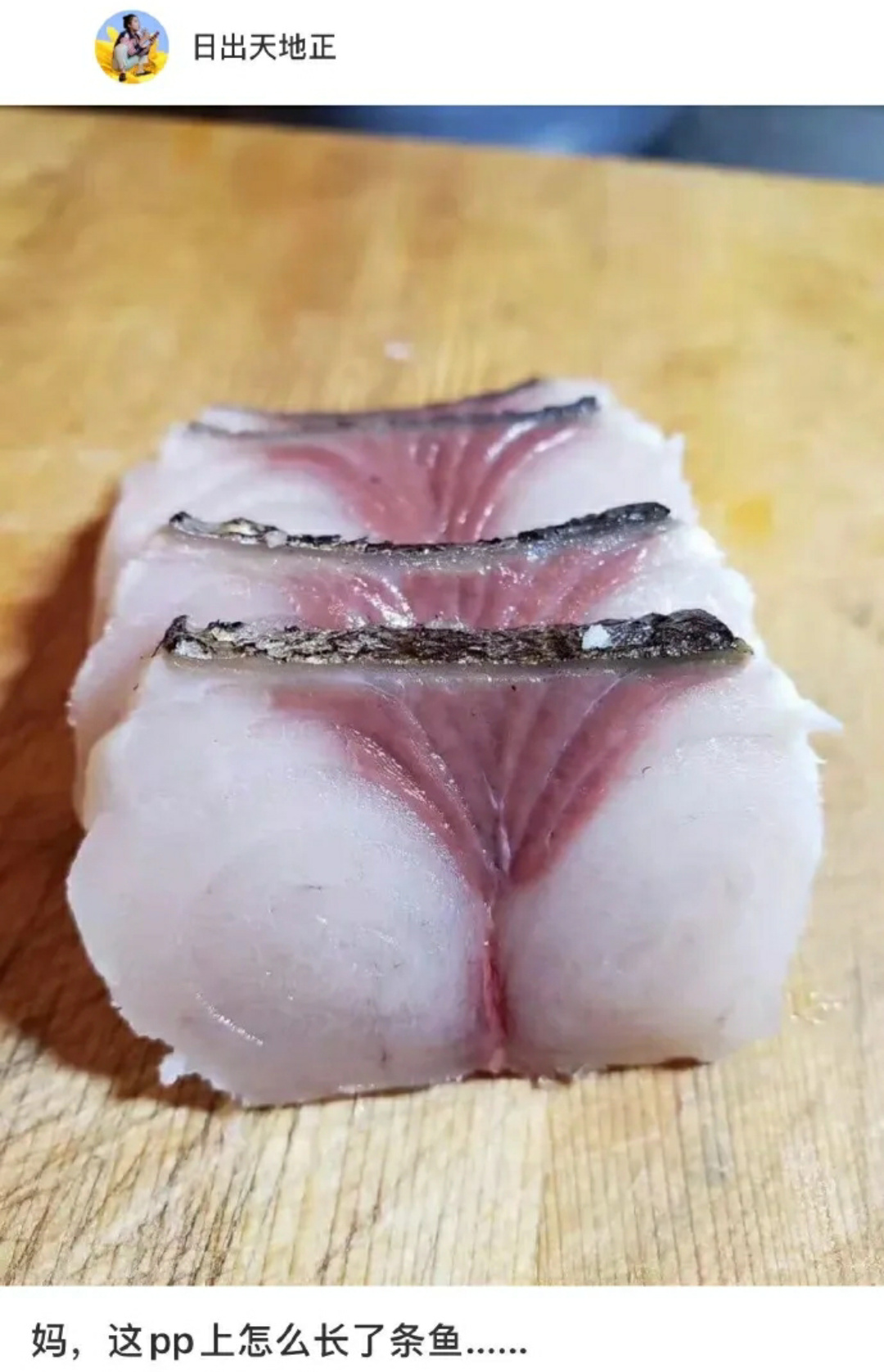 79